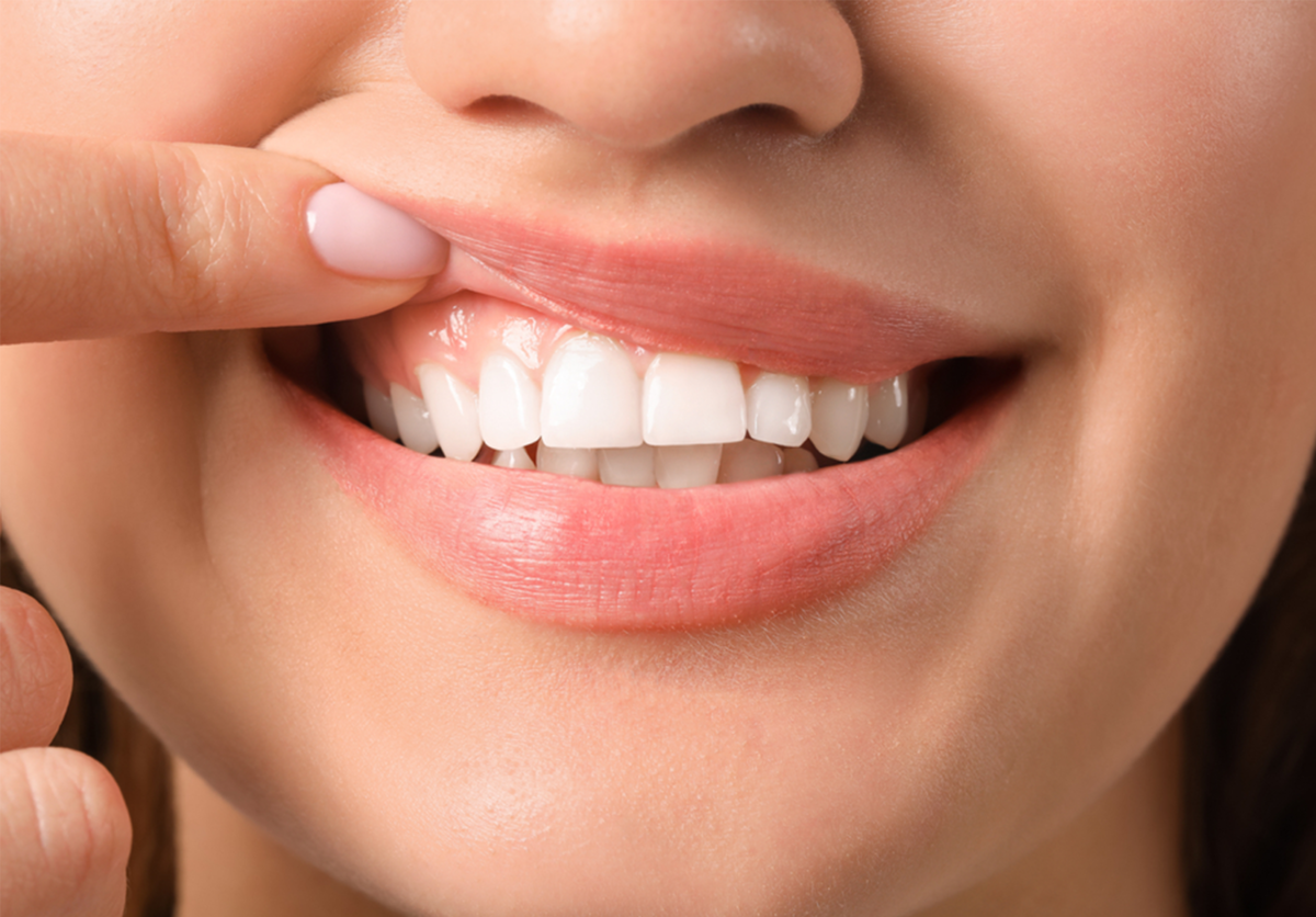 A diabetes afeta todo o corpo, incluindo dentes e gengiva