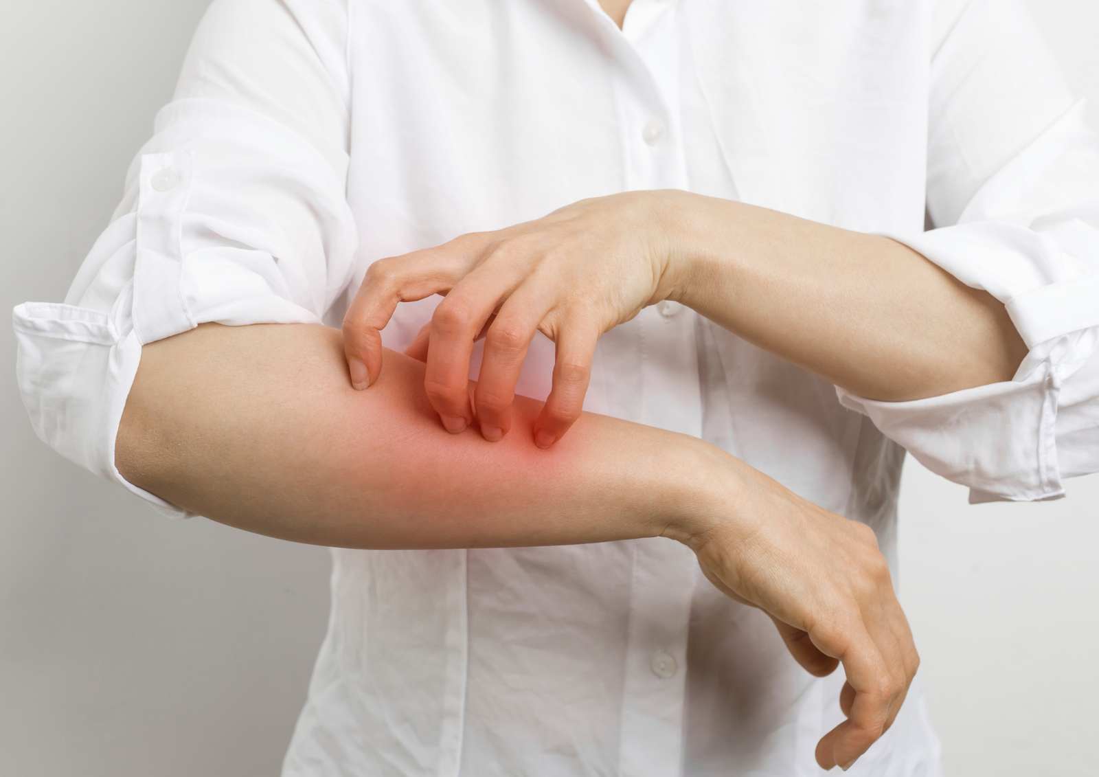 Dia Mundial da Alergia: data foca em conscientização sobre o impacto das alergias na qualidade de vida